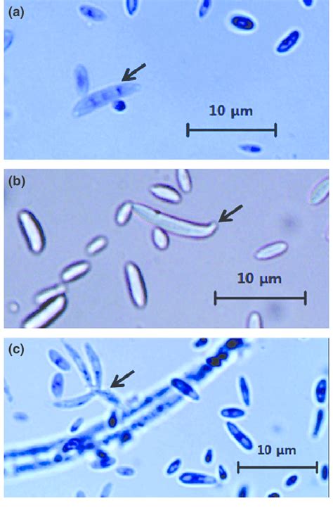 Microscopic characteristics of Fusarium oxysporum. (a) F. oxysporum... | Download Scientific Diagram