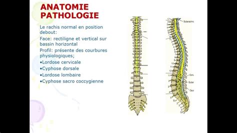 traumatologie DEVIATION DU RACHIS - YouTube