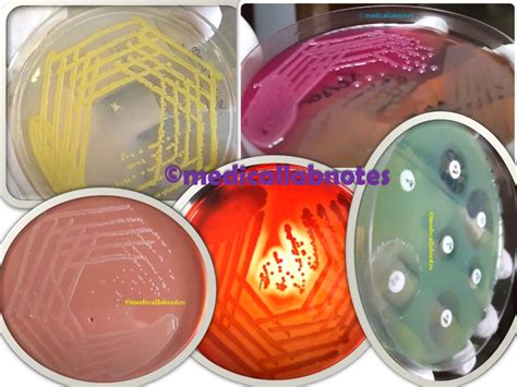 E. coli colony morphology on chocolate agar Archives - Medical Notes