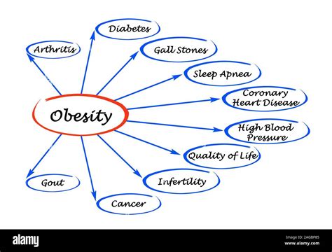 Diagram of Obesity Stock Photo - Alamy