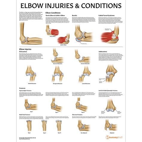 Elbow Injuries and Conditions Anatomy Poster | Pathological Anatomy Chart