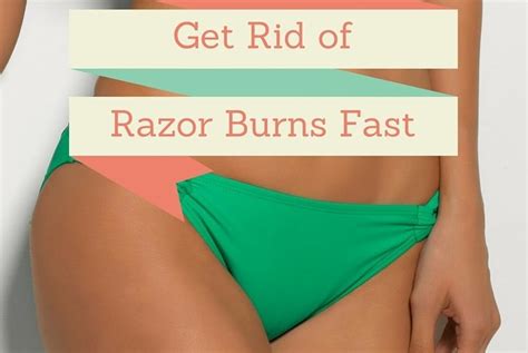 How To Get Rid of Razor Burns? - How to Treat Razor Burn Fast?