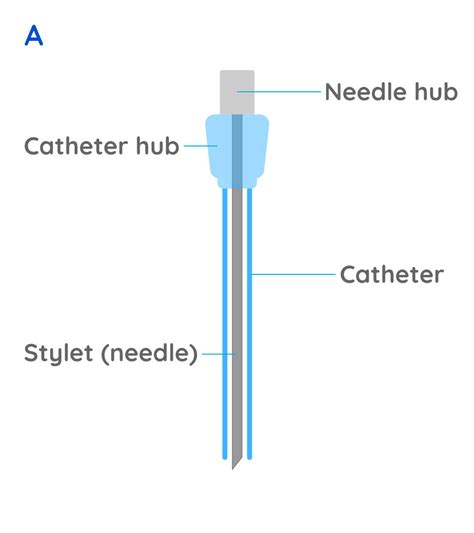 Intravenous Catheter Types