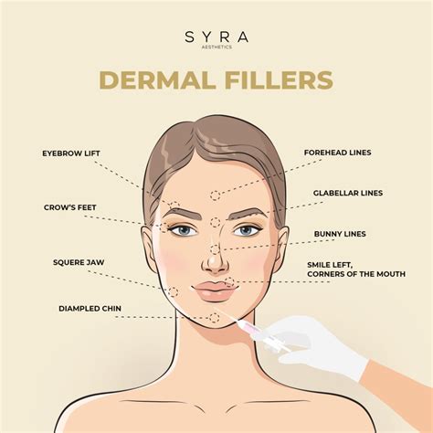 Dermal Fillers: Types, Benefits, Side Effects & More