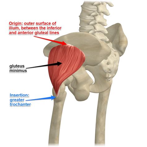 Trochanteric Bursitis Gluteus Medius Tendinopathy Coronal Stir Image | Sexiz Pix