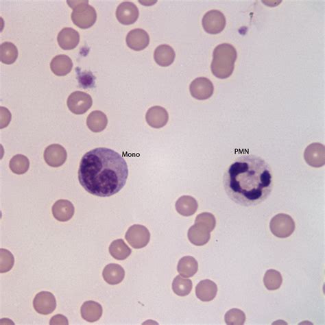 monocyte Archives | eClinpath