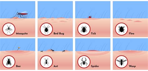 Bug Bite Identifier Chart Xxx Porn Videos Bug Bite Identifier Chart ...