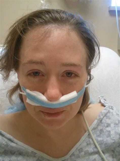 A Nose Adventure: Septoplasty: Day 1: The Surgery