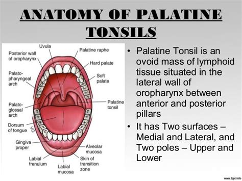 Tonsillitis case