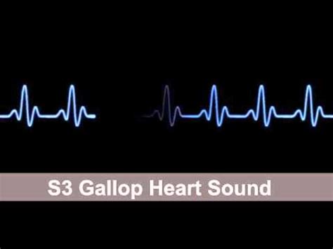 S3 Gallop Heart Sound Collection For Auscultation Skills - YouTube