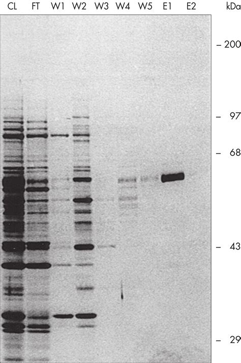 Ni-NTA Agarose