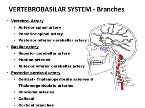 Vertebrobasilar Artery Ischemia