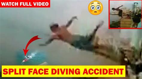 Split Face Diving Accident: Split Face Diving Video - Insidegistblog - IMPROVE-NEWS - Today's ...