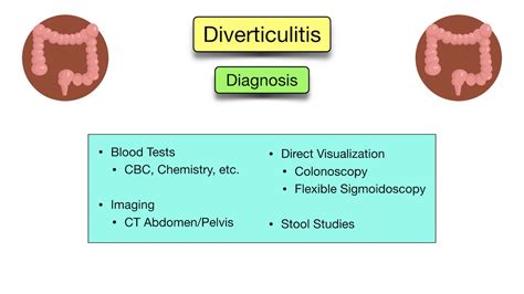 Diverticular Disease: Diverticulitis vs Diverticulosis - Symptoms, Diet, Causes, Treatment, Pain ...