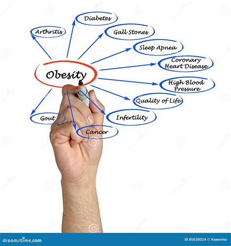 Diagram of Obesity stock photo. Image of lecture, complication - 85630024