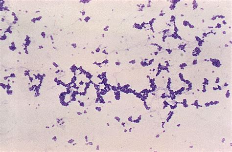 Gram Stain Procedure in Microbiology