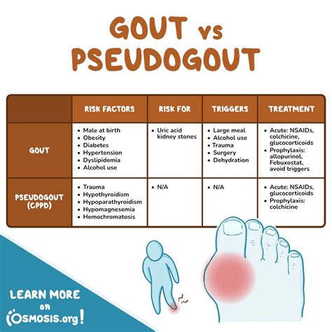 Gout Vs Pseudogout Crystals