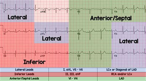 Coronary Anatomy ECG Leads REBEL EM Emergency Medicine Blog, 51% OFF