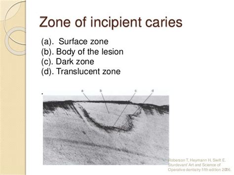 Incipient caries