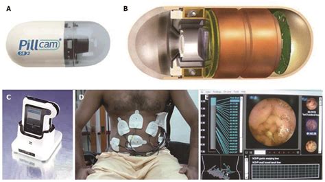 Capsule Endoscopy Uses, Side Effects, And Results, 40% OFF