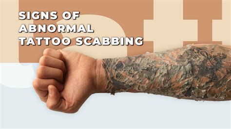 Tattoo Scabbing: Is It Normal?