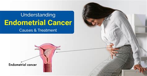 Endometrial Cancer | Treatment, Symptoms, Risk factors & Diagnosis