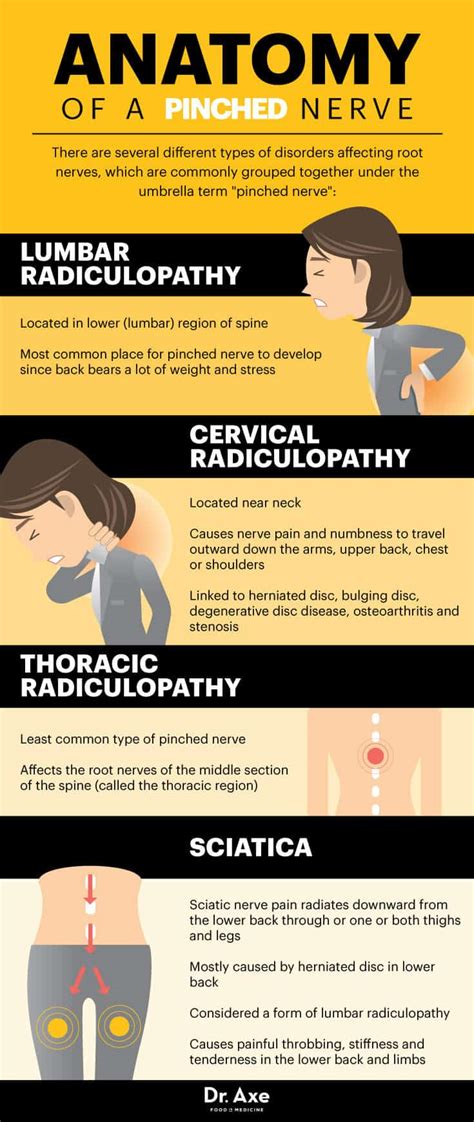 Pinched Nerve Symptoms, Locations & Treatments - Dr. Axe