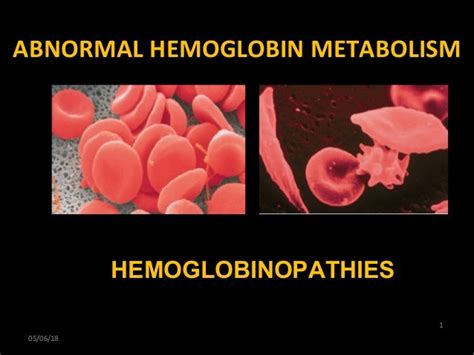 Hemoglobinopathies