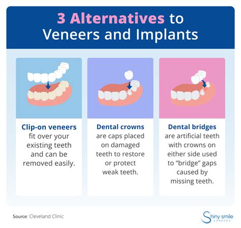 Veneers vs. Dental Implants: Which Is Right for You? | Shiny Smile Veneers