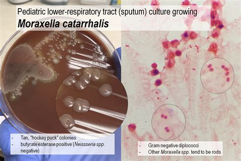 Moraxella Catarrhalis Gram Stain