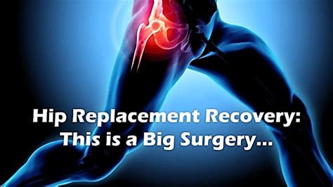 Hip Replacement Recovery: What To Know & What To Expect