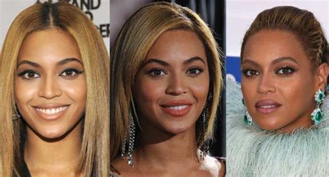 Beyonce Plastic Surgery Before and After Pictures 2024