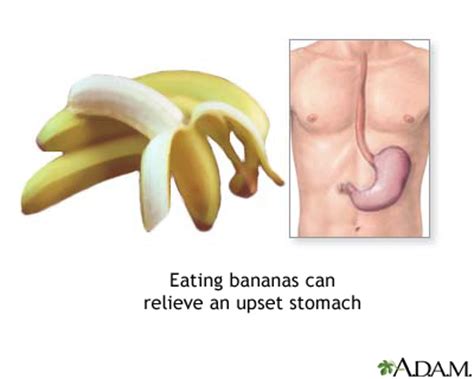 Bananas and nausea | Multimedia Encyclopedia | Health Information | St. Luke's Hospital