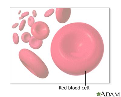 Hypochromia | UF Health, University of Florida Health