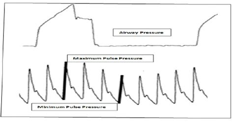 Pulse Pressure Variation | Download Scientific Diagram