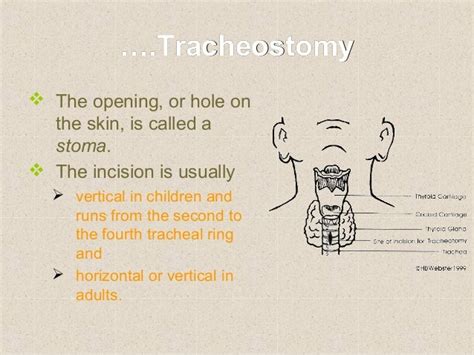 Surgical airway procedures