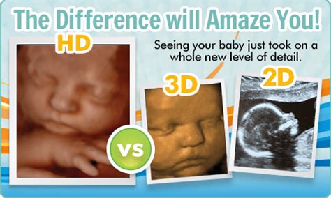 Best Time To Do 3d Ultrasound During Pregnancy | jeminileywhenilookatyou