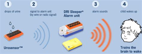 Bedwetting Alarms - Nocturnal Enuresis in Children