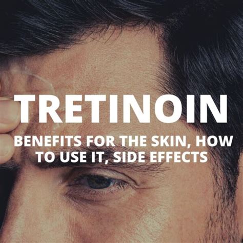 Tretinoin: Benefits for the skin, how to use it, side effects - SIXMD - Vietnamese Online Shop