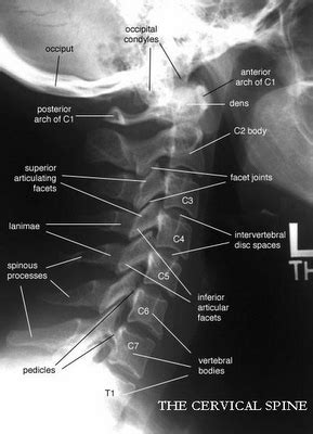 Radiographic positioning: Cervical x-ray