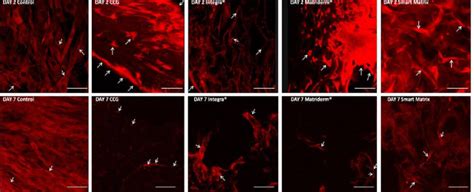 Alpha-smooth muscle actin (a-SMA) expression by immunostaining. White ...