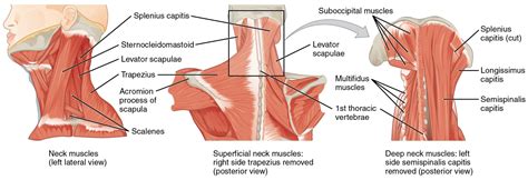 Neck Problems: Forward Head Posture (FHP)