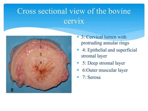 Molecular Mechanism of Cervical Ripening