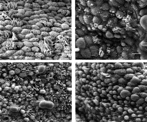 Scanning electron microscopy showing the apical surface of the luminal... | Download Scientific ...