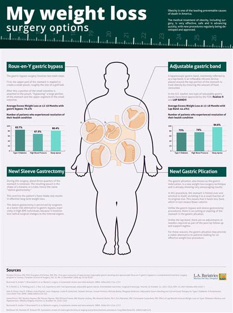 Infographic on Weight Loss Surgery Options | Marina Weight Loss