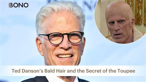 Is American Legendary Star Ten Danson Bald?