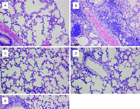 Histology of lung tissues in asthma mouse models. A: Control; B ...