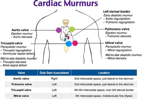 The 25+ best Aortic stenosis ideas on Pinterest | Rn schools near me ...