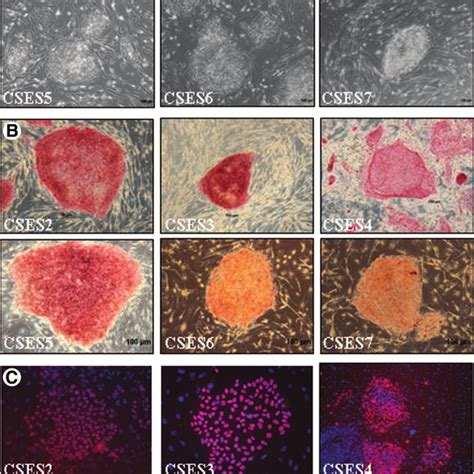 (PDF) Derivation of Euploid Human Embryonic Stem Cells from Aneuploid Embryos