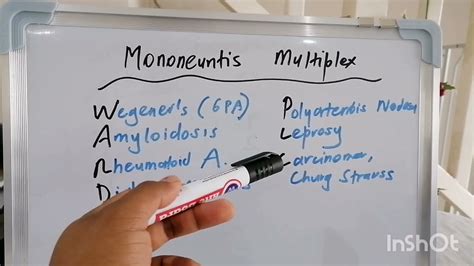 Mnemonic 2 : Mononeuritis multiplex - YouTube